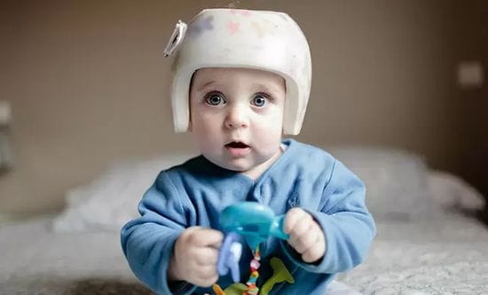 My child has plagiocephaly, what can I do?